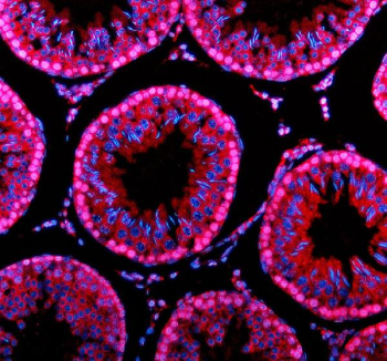 Immunofluorescent staining of PARP11 using anti-PARP11 antibody (red). PARP11 was detected in a paraffin-embedded section of rat testis tissue. Heat mediated antigen retrieval was performed in EDTA buffer (pH 8.0, epitope retrieval solution). The tissue section was blocked with 10% goat serum. The tissue section was then incubated with 5 ug/ml rabbit anti-PARP11 antibody overnight at 4oC. Cy3 Conjugated Goat Anti-Rabbit IgG was used as secondary antibody at 1:500 dilution and incubated for 30 minutes at 37oC. The section was counterstained with DAPI nuclear stain (blue). Visualize using a fluorescence microscope and filter sets appropriate for the label used.