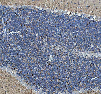 Immunohistochemical staining of SNCB using anti-SNCB antibody. SNCB was detected in a paraffin-embedded section of mouse cerebellum tissue. Heat mediated antigen retrieval was performed in EDTA buffer (pH 8.0, epitope retrieval solution). The tissue section was blocked with 10% goat serum. The tissue section was then incubated with 2 ug/ml rabbit anti-SNCB antibody overnight at 4oC. Peroxidase Conjugated Goat Anti-rabbit IgG was used as secondary antibody and incubated for 30 minutes at 37oC. The tissue section was developed using an HRP secondary and DAB substrate.