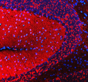 Immunofluorescent staining of SNCB using anti-SNCB antibody (red). SNCB was detected in a paraffin-embedded section of rat cerebellum tissue. Heat mediated antigen retrieval was performed in EDTA buffer (pH 8.0, epitope retrieval solution). The tissue section was blocked with 10% goat serum. The tissue section was then incubated with 5 ug/ml rabbit anti-SNCB antibody overnight at 4oC. DyLight 550 Conjugated Goat Anti-Rabbit IgG was used as secondary antibody at 1:500 dilution and incubated for 30 minutes at 37oC. The section was counterstained with DAPI nuclear stain (blue). Visualize using a fluorescence microscope and filter sets appropriate for the label used.