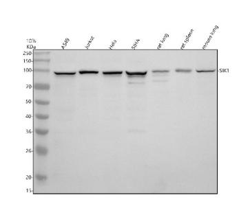 Western blot analysis of SIK1 using anti-SIK1 antibody. Electrophoresis was performed on a 10% SDS-PAGE gel at 80V (Stacking gel) / 120V (Resolving gel) for 2 hours. Lane 1: human whole cell lysates, Lane 2: human Jurkat whole cell lysates, Lane 3: human Hela whole cell lysates, Lane 4: human SIHA whole cell lysates, Lane 5: rat lung tissue lysates, Lane 6: rat spleen tissue lysates, Lane 7: mouse lung tissue lysates. After electrophoresis, proteins were transferred to a nitrocellulose membrane at 150 mA for 50-90 minutes. Blocked the membrane with 5% non-fat milk/TBS for 1.5 hour at RT. The membrane was incubated with rabbit anti-SIK1 antibody at 0.5 ug/ml overnight at 4oC, then washed with TBS-0.1%Tween 3 times with 5 minutes each and probed with a goat anti-rabbit IgG-HRP secondary antibody at a dilution of 1:5000 for 1.5 hour at RT. The signal was developed using an ECL Plus Western Blotting Substrate. The expected molecular weight of SIK1 is ~85 kDa.