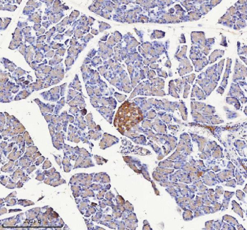 Immunohistochemical staining of NPTX2 using anti-NPTX2 antibody. NPTX2 was detected in a paraffin-embedded section of rat pancreas tissue. Heat mediated antigen retrieval was performed in EDTA buffer (pH 8.0, epitope retrieval solution). The tissue section was blocked with 10% goat serum. The tissue section was then incubated with 2 ug/ml rabbit anti-NPTX2 antibody overnight at 4oC. Peroxidase Conjugated Goat Anti-rabbit IgG was used as secondary antibody and incubated for 30 minutes at 37oC. The tissue section was developed using an HRP secondary and DAB substrate.