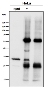 Immunoprecipitation analysis using the SDHB antibody at 1:50 dilution. Western blot performed at 1:1000 dilution. Expected molecular weight: 25-32 kDa.