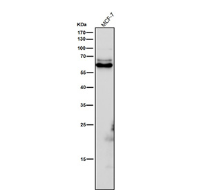 All lanes use the Phospho-CRMP2 (pThr514) antibody at 1:6000 dilution for 1 hour at room temperature. Phospho-CRMP2 (~62 kDa predicted) was detected as a major band at ~63-65 kDa, consistent with phosphorylation at GSK3Î²/CDK5-regulated residues Thr509, Thr514, and Ser522, which slightly retard electrophoretic mobility relative to total CRMP2.