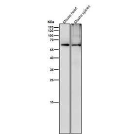 All lanes use the Phospho-CRMP2 (pThr514) antibody at 1:6000 dilution for 1 hour at room temperature. Phospho-CRMP2 (~62 kDa predicted) was detected as a major band at ~63-65 kDa, consistent with phosphorylation at GSK3Î²/CDK5-regulated residues Thr509, Thr514, and Ser522, which slightly retard electrophoretic mobility relative to total CRMP2.