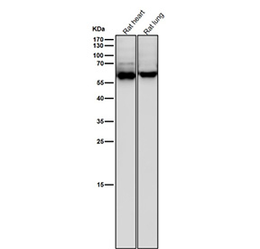 All lanes use the Phospho-CRMP2 (pThr514) antibody at 1:6000 dilution for 1 hour at room temperature. Phospho-CRMP2 (~62 kDa predicted) was detected as a major band at ~63-65 kDa, consistent with phosphorylation at GSK3Î²/CDK5-regulated residues Thr509, Thr514, and Ser522, which slightly retard electrophoretic mobility relative to total CRMP2.
