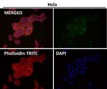 Immunofluorescent analysis using the CABP1 antibody (green) at 1:50 dilution.