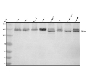 Western blot analysis of SIN3B using anti-SIN3B antibody. Electrophoresis was performed on a 8% SDS-PAGE gel at 80V (Stacking gel) / 120V (Resolving gel) for 2 hours. Lane 1: human PC-3 whole cell lysates, Lane 2: human 293T whole cell lysates, Lane 3: human Caco-2 whole cell lysates, Lane 4: human MCF-7 whole cell lysates, Lane 5: rat testis tissue lysates, Lane 6: rat C6 whole cell lysates, Lane 7: mouse testis tissue lysates, Lane 8: mouse NIH/3T3 whole cell lysates. After electrophoresis, proteins were transferred to a nitrocellulose membrane at 150 mA for 50-90 minutes. Blocked the membrane with 5% non-fat milk/TBS for 1.5 hour at RT. The membrane was incubated with rabbit anti-SIN3B antibody at 0.5 ug/ml overnight at 4oC, then washed with TBS-0.1%Tween 3 times with 5 minutes each and probed with a goat anti-rabbit IgG-HRP secondary antibody at a dilution of 1:5000 for 1.5 hour at RT. The signal was developed using an ECL Plus Western Blotting Substrate. SIN3B (~133 kDa predicted) was detected as a doublet around ~150 kDa in human lysates and a slightly lower doublet in mouse and rat tissues, consistent with known phosphorylation-dependent mobility and alternative isoform expression of the SIN3B scaffold protein.