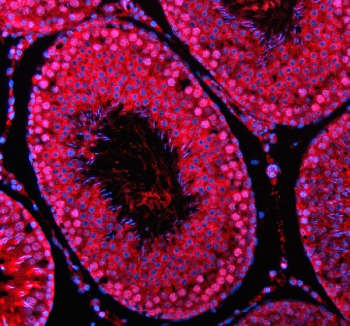 Immunofluorescent staining of SIN3B using anti-SIN3B antibody (red). SIN3B was detected in a paraffin-embedded section of rat testis tissue. Heat mediated antigen retrieval was performed in EDTA buffer (pH 8.0, epitope retrieval solution). The tissue section was blocked with 10% goat serum. The tissue section was then incubated with 5 ug/ml rabbit anti-SIN3B antibody overnight at 4oC. Cy3 Conjugated Goat Anti-Rabbit IgG was used as secondary antibody at 1:500 dilution and incubated for 30 minutes at 37oC. The section was counterstained with DAPI nuclear stain (blue). Visualize using a fluorescence microscope and filter sets appropriate for the label used.