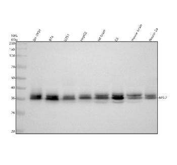Western blot analysis of MSI2 using anti-MSI2 antibody. Electrophoresis was performed on a 10% SDS-PAGE gel at 80V (Stacking gel) / 120V (Resolving gel) for 2 hours. Lane 1: human SH-SY5Y whole cell lysates, Lane 2: human RT4 whole cell lysates, Lane 3: human U251 whole cell lysates, Lane 4: human HepG2 whole cell lysates, Lane 5: rat brain tissue lysates, Lane 6: rat C6 tissue lysates, Lane 7: mouse brain tissue lysates, Lane 8: mouse Neuro-2a tissue lysates. After electrophoresis, proteins were transferred to a nitrocellulose membrane at 150 mA for 50-90 minutes. Blocked the membrane with 5% non-fat milk/TBS for 1.5 hour at RT. The membrane was incubated with rabbit anti-MSI2 antibody at 0.5 ug/ml overnight at 4oC, then washed with TBS-0.1%Tween 3 times with 5 minutes each and probed with a goat anti-rabbit IgG-HRP secondary antibody at a dilution of 1:5000 for 1.5 hour at RT. The signal was developed using an ECL Plus Western Blotting Substrate. MSI2 (~35-39 kDa predicted, isoform-dependent) was detected as a tight doublet at ~35-38 kDa, consistent with documented phosphorylation-dependent mobility shifts and small isoform size differences for MSI2.