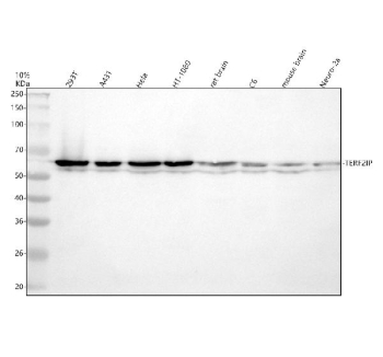 Western blot analysis of TERF2IP using anti-TERF2IP antibody. Electrophoresis was performed on a 10% SDS-PAGE gel at 80V (Stacking gel) / 120V (Resolving gel) for 2 hours. Lane 1: human 293T whole cell lysates, Lane 2: human whole cell lysates, Lane 3: human Hela whole cell lysates, Lane 4: human HT1080 whole cell lysates, Lane 5: rat brain tissue lysates, Lane 6: rat C6 whole cell lysates, Lane 7: mouse brain tissue lysates, Lane 8: mouse Neuro-2a whole cell lysates. After electrophoresis, proteins were transferred to a nitrocellulose membrane at 150 mA for 50-90 minutes. Blocked the membrane with 5% non-fat milk/TBS for 1.5 hour at RT. The membrane was incubated with rabbit anti-TERF2IP antibody at 0.5 ug/ml overnight at 4oC, then washed with TBS-0.1%Tween 3 times with 5 minutes each and probed with a goat anti-rabbit IgG-HRP secondary antibody at a dilution of 1:5000 for 1.5 hour at RT. The signal was developed using an ECL Plus Western Blotting Substrate. A predominant doublet is detected at ~60 kDa, higher than the calculated ~45 kDa. The slower migration and split bands are consistent with known RAP1 post-translational modifications (SUMOylation and phosphorylation) and isoform heterogeneity.