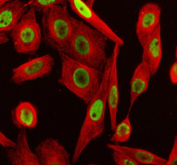 Immunofluorescent staining of TERF2IP using anti-TERF2IP antibody (red) and anti-Beta Tubulin antibody (green). TERF2IP was detected in an immunocytochemical section of SIHA cells. Enzyme antigen retrieval was performed using IHC enzyme antigen retrieval reagent for 15 mins. The cells were blocked with 10% goat serum. And then incubated with 5 ug/ml rabbit anti-TERF2IP antibody and mouse anti-Beta Tubulin antibody overnight at 4oC. DyLight 488 Conjugated Goat Anti-Rabbit IgG and Cy3 Conjugated Goat Anti-Mouse IgG were used as secondary antibody at 1:500 dilution and incubated for 30 minutes at 37oC. Visualize using a fluorescence microscope and filter sets appropriate for the label used.