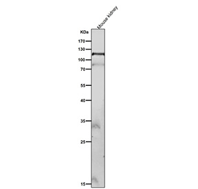 Mouse kidney tissue lysate tested with Phospho-FAK (pTyr576/pTyr577) antibody at 1:2000 dilution for 1 hour at room temperature. Predicted molecular weight ~120 kDa.