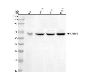 Western blot analysis of MARVELD2 using anti-MARVELD2 antibody. Lane 1: human RT4 whole cell lysates, Lane 2: human Caco-2 whole cell lysates, Lane 3: human whole cell lysates, Lane 4: human MCF-7 whole cell lysates. After electrophoresis, proteins were transferred to a nitrocellulose membrane at 150 mA for 50-90 minutes. Blocked the membrane with 5% non-fat milk/TBS for 1.5 hour at RT. The membrane was incubated with rabbit anti-MARVELD2 antibody at 0.5 ug/ml overnight at 4oC, then washed with TBS-0.1%Tween 3 times with 5 minutes each and probed with a goat anti-rabbit IgG-HRP secondary antibody at a dilution of 1:5000 for 1.5 hour at RT. The signal was developed using enhanced chemiluminescent. A specific band was detected for MARVELD2 at approximately 64 kDa. The expected molecular weight of MARVELD2 is ~64 kDa.