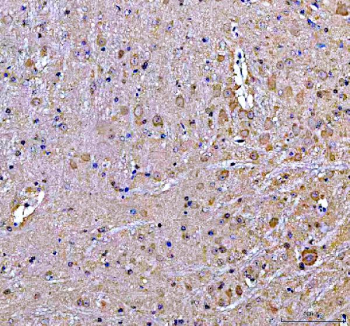Immunohistochemical staining of SOS1 using anti-SOS1 antibody. SOS1 was detected in a paraffin-embedded section of rat cerebellum tissue. Heat mediated antigen retrieval was performed in EDTA buffer (pH 8.0, epitope retrieval solution). The tissue section was blocked with 10% goat serum. The tissue section was then incubated with 2 ug/ml rabbit anti-SOS1 antibody overnight at 4oC. Peroxidase Conjugated Goat Anti-rabbit IgG was used as secondary antibody and incubated for 30 minutes at 37oC. The tissue section was developed using an HRP secondary and DAB substrate.