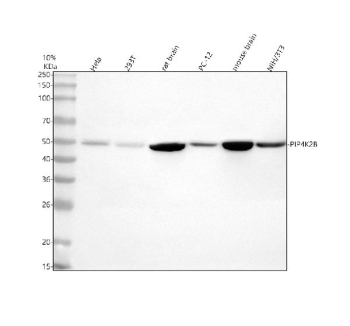 Western blot analysis of PIP4K2B using anti-PIP4K2B antibody. Electrophoresis was performed on a 10% SDS-PAGE gel at 80V (Stacking gel) / 120V (Resolving gel) for 2 hours. Lane 1: human Hela whole cell lysates, Lane 2: human 293T whole cell lysates, Lane 3: rat brain tissue lysates, Lane 4: rat PC-12 whole cellue lysates, Lane 5: mouse brain tissue lysates, Lane 6: mouse NIH/3T3 whole cell lysates. After electrophoresis, proteins were transferred to a nitrocellulose membrane at 150 mA for 50-90 minutes. Blocked the membrane with 5% non-fat milk/TBS for 1.5 hour at RT. The membrane was incubated with rabbit anti-PIP4K2B antibody at 0.5 ug/ml overnight at 4oC, then washed with TBS-0.1%Tween 3 times with 5 minutes each and probed with a goat anti-rabbit IgG-HRP secondary antibody at a dilution of 1:5000 for 1.5 hour at RT. The signal was developed using an ECL Plus Western Blotting Substrate. The expected molecular weight of PIP4K2B is ~47 kDa.