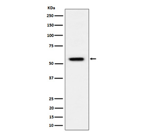 Phospho-Vimentin (Ser39) Antibody / Mitotic Marker Antibody Calyculin A-Treated HeLa WB. Western blot analysis of lysate from Calyculin A-treated HeLa cells using Phospho-Vimentin (Ser39) Antibody / Mitotic Marker Antibody. A distinct immunoreactive band is detected at approximately 53-58 kDa, consistent with the expected molecular weight of phosphorylated vimentin. Calyculin A treatment promotes accumulation of serine 39-phosphorylated vimentin through inhibition of protein phosphatases, supporting specific detection of this phosphorylation event associated with mitotic signaling and intermediate filament remodeling.
