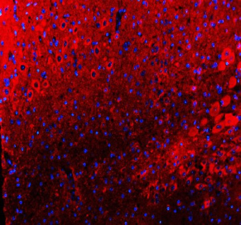 Immunofluorescent staining of TIGAR using anti-TIGAR antibody (red). TIGAR was detected in a paraffin-embedded section of mouse cerebellum tissue. Heat mediated antigen retrieval was performed in EDTA buffer (pH 8.0, epitope retrieval solution). The tissue section was blocked with 10% goat serum. The tissue section was then incubated with 5 ug/ml rabbit anti-TIGAR antibody overnight at 4oC. Cy3 Conjugated Goat Anti-Rabbit IgG was used as secondary antibody at 1:500 dilution and incubated for 30 minutes at 37oC. The section was counterstained with DAPI nuclear stain (blue). Visualize using a fluorescence microscope and filter sets appropriate for the label used.