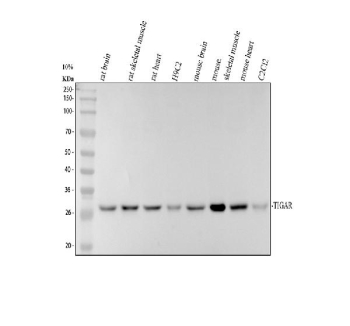 Western blot analysis of TIGAR using anti-TIGAR antibody. Electrophoresis was performed on a 10% SDS-PAGE gel at 80V (Stacking gel) / 120V (Resolving gel) for 2 hours. Lane 1: rat brain tissue lysates, Lane 2: rat skeletal muscle tissue lysates, Lane 3: rat heart tissue lysates, Lane 4: rat H9C2 whole cell lysates, Lane 5: mouse brain tissue lysates, Lane 6: mouse skeletal muscle tissue lysates, Lane 7: mouse heart tissue lysates, Lane 8: mouse C2C12 whole cell lysates. After electrophoresis, proteins were transferred to a nitrocellulose membrane at 150 mA for 50-90 minutes. Blocked the membrane with 5% non-fat milk/TBS for 1.5 hour at RT. The membrane was incubated with rabbit anti-TIGAR antibody at 0.5 ug/ml overnight at 4oC, then washed with TBS-0.1%Tween 3 times with 5 minutes each and probed with a goat anti-rabbit IgG-HRP secondary antibody at a dilution of 1:5000 for 1.5 hour at RT. The signal was developed using an ECL Plus Western Blotting Substrate. A specific band was detected for TIGAR at approximately 30 kDa. The expected molecular weight of TIGAR is ~30 kDa.