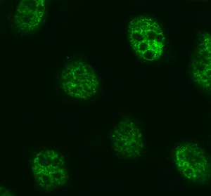 MED28 Antibody in Human U2OS Osteosarcoma Cells IF. Immunofluorescence staining of human U2OS osteosarcoma cells with MED28 Antibody / Mediator complex subunit 28 at 5 ug/ml. Enzyme-mediated antigen retrieval was performed for 15 min, followed by blocking with 10% goat serum. Cells were incubated with the primary antibody overnight at 4oC. Fluoro488-conjugated goat anti-rabbit IgG was used as the secondary antibody at 1:500 for 30 min at 37oC. MED28 staining is predominantly localized to the nuclei. This MED28 Antibody enables visualization of Mediator complex subunit 28 expression and localization in human osteosarcoma cells.
