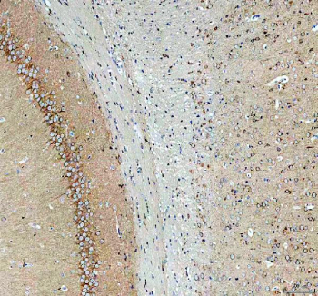 Immunohistochemical staining of SEZ6L2 using anti-SEZ6L2 antibody. SEZ6L2 was detected in a paraffin-embedded section of rat brain tissue. Heat mediated antigen retrieval was performed in EDTA buffer (pH 8.0, epitope retrieval solution). The tissue section was blocked with 10% goat serum. The tissue section was then incubated with 2 ug/ml rabbit anti-SEZ6L2 antibody overnight at 4oC. Peroxidase Conjugated Goat Anti-rabbit IgG was used as secondary antibody and incubated for 30 minutes at 37oC. The tissue section was developed using an HRP secondary and DAB substrate.