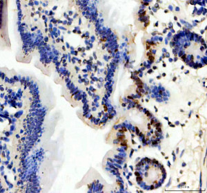 ITPKC Antibody by IHC in mouse colon. Immunohistochemistry of FFPE mouse colon tissue using ITPKC Antibody at 2 ug/ml. Brown immunoreactivity is concentrated in scattered epithelial cells and portions of the glandular structures, with prominent staining near the basal regions of several crypts. Much of the surrounding epithelium exhibits relatively weak staining, while nuclei are counterstained blue-purple. The heterogeneous pattern suggests localized ITPKC immunoreactivity within the intestinal mucosa. Heat-mediated antigen retrieval was performed in EDTA buffer at pH 8.0, followed by overnight primary antibody incubation at 4oC. This Inositol Trisphosphate 3-Kinase C Polyclonal Antibody demonstrates epithelial immunoreactivity.