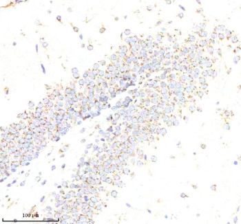 Immunohistochemical staining of ABR using anti-ABR antibody. ABR was detected in a paraffin-embedded section of rat brain tissue. Heat mediated antigen retrieval was performed in EDTA buffer (pH 8.0, epitope retrieval solution). The tissue section was blocked with 10% goat serum. The tissue section was then incubated with 2 ug/ml rabbit anti-ABR antibody overnight at 4oC. Peroxidase Conjugated Goat Anti-rabbit IgG was used as secondary antibody and incubated for 30 minutes at 37oC. The tissue section was developed using an HRP secondary and DAB substrate.