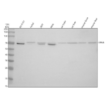 DTNB Antibody Human Mouse Rat WB. Western blot analysis of 1) human SH-SY5Y, 2) human Jurkat, 3) human 293T, 4) human SiHa, 5) rat brain, 6) rat liver, 7) mouse brain, and 8) mouse liver lysates using DTNB antibody. A prominent immunoreactive band is detected at approximately 66-70 kDa, consistent with the expected molecular weight range of Dystrobrevin Beta (DTNB). Human cell lysates exhibit a closely spaced doublet near 70 kDa, which may reflect alternatively spliced isoforms or post-translationally modified forms of DTNB. In contrast, rat and mouse tissue lysates predominantly display a single major band corresponding to the conserved DTNB protein. Dystrobrevin Beta is a component of the dystrophin-associated protein complex involved in cytoskeletal organization, membrane stability, and intracellular signaling. The observed cross-species reactivity supports the utility of this DTNB antibody for western blot detection of endogenous DTNB expression in both human and rodent samples. Predicted molecular weight: ~66-70 kDa.