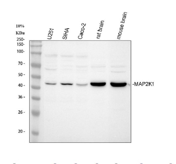 Western blot analysis of MAP2K1 using anti-MAP2K1 antibody. Electrophoresis was performed on a 10% SDS-PAGE gel at 80V (Stacking gel) / 120V (Resolving gel) for 2 hours. Lane 1: human U251 whole cell lysates, Lane 2: human SiHa whole cell lysates, Lane 3: human CACO-2 whole cell lysates, Lane 4: rat brain tissue lysates, Lane 5: mouse brain tissue lysates. After electrophoresis, proteins were transferred to a nitrocellulose membrane at 150 mA for 50-90 minutes. Blocked the membrane with 5% non-fat milk/TBS for 1.5 hour at RT. The membrane was incubated with rabbit anti-MAP2K1 antibody at 0.5 ug/ml overnight at 4oC, then washed with TBS-0.1%Tween 3 times with 5 minutes each and probed with a goat anti-rabbit IgG-HRP secondary antibody at a dilution of 1:5000 for 1.5 hour at RT. The signal is developed using an ECL Plus Western Blotting Substratewith Tanon 5200 system. A specific band was detected for MAP2K1 at approximately 45 kDa. The expected molecular weight of MAP2K1 is ~45 kDa.