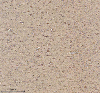 Immunohistochemical staining of TRIM2 using anti-TRIM2 antibody. TRIM2 was detected in a paraffin-embedded section of rat brain tissue. Heat mediated antigen retrieval was performed in EDTA buffer (pH 8.0, epitope retrieval solution). The tissue section was blocked with 10% goat serum. The tissue section was then incubated with 2 ug/ml rabbit anti-TRIM2 antibody overnight at 4oC. Peroxidase Conjugated Goat Anti-rabbit IgG was used as secondary antibody and incubated for 30 minutes at 37oC. The tissue section was developed using an HRP secondary and DAB substrate.