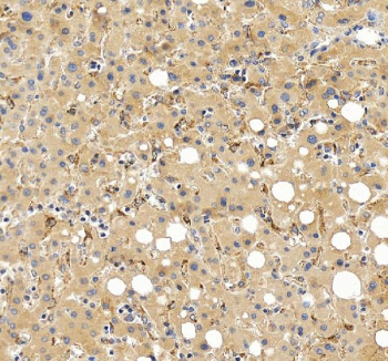Immunohistochemical staining of FGL1 using anti-FGL1 antibody. FGL1 was detected in a paraffin-embedded section of human liver tissue. Heat mediated antigen retrieval was performed in EDTA buffer (pH 8.0, epitope retrieval solution). The tissue section was blocked with 10% goat serum. The tissue section was then incubated with 2 ug/ml rabbit anti-FGL1 antibody overnight at 4oC. Peroxidase Conjugated Goat Anti-rabbit IgG was used as secondary antibody and incubated for 30 minutes at 37oC. The tissue section was developed using an HRP secondary and DAB substrate.