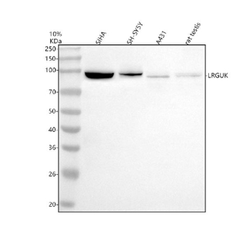 Western blot analysis of LRGUK using anti-LRGUK antibody. Electrophoresis was performed on a 10% SDS-PAGE gel at 80V (Stacking gel) / 120V (Resolving gel) for 2 hours. Lane 1: human SIHA whole cell lysates, Lane 2: human SH-SY5Y whole cell lysates, Lane 3: human whole cell lysates, Lane 4: rat testis tissue lysates. After electrophoresis, proteins were transferred to a nitrocellulose membrane at 150 mA for 50-90 minutes. Blocked the membrane with 5% non-fat milk/TBS for 1.5 hour at RT. The membrane was incubated with rabbit anti-LRGUK antibody at 0.5 ug/ml overnight at 4oC, then washed with TBS-0.1%Tween 3 times with 5 minutes each and probed with a goat anti-rabbit IgG-HRP secondary antibody at a dilution of 1:5000 for 1.5 hour at RT. The signal was developed using an ECL Plus Western Blotting Substrate. A specific band was detected for LRGUK at approximately 94 kDa. The expected molecular weight of LRGUK is ~94 kDa.
