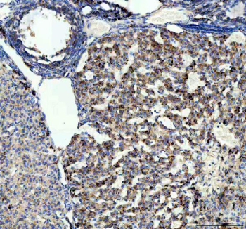 Immunohistochemical staining of STRIP1 using anti-STRIP1 antibody. STRIP1 was detected in a paraffin-embedded section of mouse ovary tissue. Heat mediated antigen retrieval was performed in EDTA buffer (pH 8.0, epitope retrieval solution). The tissue section was blocked with 10% goat serum. The tissue section was then incubated with 2 ug/ml rabbit anti-STRIP1 antibody overnight at 4oC. Peroxidase Conjugated Goat Anti-rabbit IgG was used as secondary antibody and incubated for 30 minutes at 37oC. The tissue section was developed using an HRP secondary and DAB substrate.