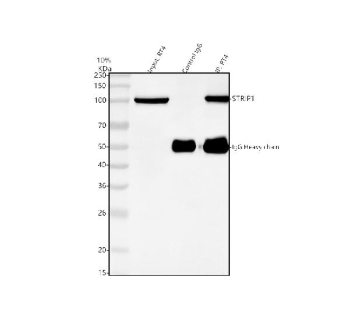 Immunoprecipitating (IP) STRIP1 in RT4 whole cell lysate. Western blot analysis of STRIP1 using anti-STRIP1 antibody; Lane 1: RT4 whole cell lysates (30ug); Lane 2: Rabbit control IgG instead of anti-STRIP1 antibody in RT4 whole cell lysate; Lane 3: anti-STRIP1 antibody (2ug) + RT4 whole cell lysate (500ug). After electrophoresis, proteins were transferred to a membrane. Then the membrane was incubated with rabbit anti-STRIP1 antibody at a dilution of 0.5 ug/ml and probed with a goat anti-rabbit IgG-HRP secondary antibody. The signal is developed using ECL Plus Western Blotting Substrate. The expected molecular weight of STRIP1 is at 96 kDa.