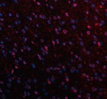 Immunofluorescent staining of NCDN using anti-NCDN antibody (red). NCDN was detected in a paraffin-embedded section of mouse brain tissue. Heat mediated antigen retrieval was performed in EDTA buffer (pH 8.0, epitope retrieval solution). The tissue section was blocked with 10% goat serum. The tissue section was then incubated with 5 ug/ml rabbit anti-NCDN antibody overnight at 4oC. Cy3 Conjugated Goat Anti-Rabbit IgG was used as secondary antibody at 1:500 dilution and incubated for 30 minutes at 37oC. The section was counterstained with DAPI nuclear stain (blue). Visualize using a fluorescence microscope and filter sets appropriate for the label used.