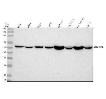 Western blot analysis of ATP6V1B2 using anti-ATP6V1B2 antibody. Lane 1: human Hela whole cell lysates, Lane 2: human whole cell lysates, Lane 3: human K562 whole cell lysates, Lane 4: human Jurkat whole cell lysates, Lane 5: rat brain tissue lysates, Lane 6: rat H9C2(2-1) whole cell lysates, Lane 7: mouse brain tissue lysates, Lane 8: mouse C2C12 whole cell lysates. After electrophoresis, proteins were transferred to a nitrocellulose membrane at 150 mA for 50-90 minutes. Blocked the membrane with 5% non-fat milk/TBS for 1.5 hour at RT. The membrane was incubated with rabbit anti-ATP6V1B2 antibody at 0.25 ug/ml overnight at 4oC, then washed with TBS-0.1%Tween 3 times with 5 minutes each and probed with a goat anti-rabbit IgG-HRP secondary antibody at a dilution of 1:5000 for 1.5 hour at RT. The signal was developed using enhanced chemiluminescent. A specific band was detected for ATP6V1B2 at approximately 57 kDa. The expected molecular weight of ATP6V1B2 is ~57 kDa.