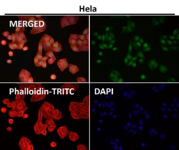 Deoxyuridine Triphosphatase Antibody HeLa IF. Immunofluorescent staining of HeLa cells using Deoxyuridine Triphosphatase Antibody demonstrates strong nuclear localization of DUT (green), consistent with the expected distribution of the mature nuclear dUTPase isoform involved in regulation of nucleotide pools and preservation of DNA integrity. Deoxyuridine Triphosphatase is a nucleotide metabolism enzyme that prevents inappropriate uracil incorporation into DNA and supports genome maintenance during cellular proliferation. Phalloidin-TRITC staining (red) visualizes the actin cytoskeleton, while DAPI (blue) identifies cell nuclei. The observed staining pattern is consistent with the established role of DUT in DNA replication fidelity, nucleotide homeostasis, and genomic stability pathways. Immunofluorescent staining was performed using DUT antibody at a 1:150 dilution.