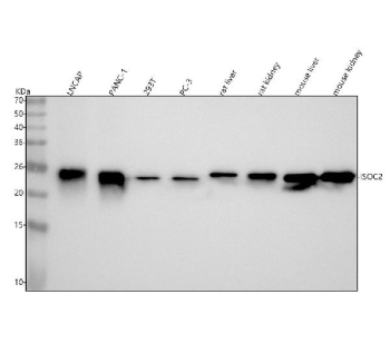 Western blot analysis of ISOC2 using anti-ISOC2 antibody. Lane 1: human LNCAP whole cell lysates, Lane 2: human PANC-1 whole cell lysates, Lane 3: human 293T whole cell lysates, Lane 4: human PC-3 whole cell lysates, Lane 5: rat liver tissue lysates, Lane 6: rat kidney tissue lysates, Lane 7: mouse liver tissue lysates, Lane 8: mouse kidney tissue lysates. After electrophoresis, proteins were transferred to a nitrocellulose membrane at 150 mA for 50-90 minutes. Blocked the membrane with 5% non-fat milk/TBS for 1.5 hour at RT. The membrane was incubated with rabbit anti-ISOC2 antibody at 0.25 ug/ml overnight at 4oC, then washed with TBS-0.1%Tween 3 times with 5 minutes each and probed with a goat anti-rabbit IgG-HRP secondary antibody at a dilution of 1:5000 for 1.5 hour at RT. The signal was developed using enhanced chemiluminescent. A specific band was detected for ISOC2 at approximately 22 kDa. The expected molecular weight of ISOC2 is ~22 kDa.