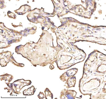 Immunohistochemical staining of PTCD1 using anti-PTCD1 antibody. PTCD1 was detected in a paraffin-embedded section of human placenta tissue. Heat mediated antigen retrieval was performed in EDTA buffer (pH 8.0, epitope retrieval solution). The tissue section was blocked with 10% goat serum. The tissue section was then incubated with 2 ug/ml rabbit anti-PTCD1 antibody overnight at 4oC. Peroxidase Conjugated Goat Anti-rabbit IgG was used as secondary antibody and incubated for 30 minutes at 37oC. The tissue section was developed using an HRP secondary and DAB substrate.