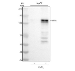 HIF1A Antibody Hypoxia-Induced WB. Western blot analysis of human HepG2 whole cell lysates using HIF1A antibody under normoxic and CoCl2-treated hypoxia-mimetic conditions. A prominent band is detected near 100-120 kDa following CoCl2 treatment, consistent with the predicted molecular weight of HIF-1-alpha and stabilization of this oxygen-sensitive transcription factor during hypoxic stress signaling. The observed induction pattern supports the role of HIF1A in hypoxia-responsive transcriptional regulation, metabolic adaptation, and cellular stress-response pathways.