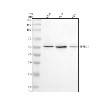 Western blot analysis of SPRED1 using anti-SPRED1 antibody. Electrophoresis was performed on a 10% SDS-PAGE gel at 80V (Stacking gel) / 120V (Resolving gel) for 2 hours. Lane 1: human K562 whole cell lysates, Lane 2: human PC-3 whole cell lysates, Lane 3: human HEL whole cell lysates. After electrophoresis, proteins were transferred to a nitrocellulose membrane at 150 mA for 50-90 minutes. Blocked the membrane with 5% non-fat milk/TBS for 1.5 hour at RT. The membrane was incubated with rabbit anti-SPRED1 antibody at 0.5 ug/ml overnight at 4oC, then washed with TBS-0.1%Tween 3 times with 5 minutes each and probed with a goat anti-rabbit IgG-HRP secondary antibody at a dilution of 1:5000 for 1.5 hour at RT. The signal was developed using an ECL Plus Western Blotting Substrate. A specific band was detected for SPRED1 at approximately 50 kDa. The expected molecular weight of SPRED1 is ~50 kDa.