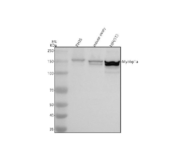 Western blot analysis of MYBBP1A using anti-MYBBP1A antibody. Electrophoresis was performed on a 8% SDS-PAGE gel at 80V (Stacking gel) / 120V (Resolving gel) for 2 hours. Lane 1: rat RH35 whole cell lysates, Lane 2: mouse ovary tissue lysates, Lane 3: mouse NIH/3T3 tissue lysates. After electrophoresis, proteins were transferred to a nitrocellulose membrane at 150 mA for 50-90 minutes. Blocked the membrane with 5% non-fat milk/TBS for 1.5 hour at RT. The membrane was incubated with rabbit anti-MYBBP1A antibody at 0.5 ug/ml overnight at 4oC, then washed with TBS-0.1%Tween 3 times with 5 minutes each and probed with a goat anti-rabbit IgG-HRP secondary antibody at a dilution of 1:5000 for 1.5 hour at RT. The signal was developed using an ECL Plus Western Blotting Substrate. A predominant doublet is observed at ~149-155 kDa, consistent with differential post-translationally modified forms of the nucleolar protein.