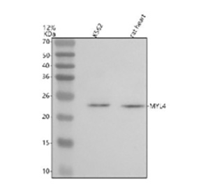 Western blot analysis of MYL4 using anti-MYL4 antibody. Lane 1: human K562 whole cell lysates, Lane 2: rat heart tissue lysates. After electrophoresis, proteins were transferred to a nitrocellulose membrane at 150 mA for 50-90 minutes. Blocked the membrane with 5% non-fat milk/TBS for 1.5 hour at RT. The membrane was incubated with rabbit anti-MYL4 antibody at 0.5 ug/ml overnight at 4oC, then washed with TBS-0.1%Tween 3 times with 5 minutes each and probed with a goat anti-rabbit IgG-HRP secondary antibody at a dilution of 1:5000 for 1.5 hour at RT. The signal was developed using enhanced chemiluminescent. The expected molecular weight of MYL4 is ~22 kDa.