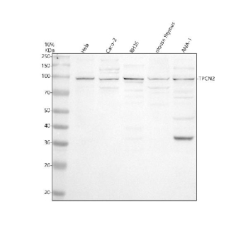 Western blot analysis of TPCN2 using anti-TPCN2 antibody. Electrophoresis was performed on a 10% SDS-PAGE gel at 80V (Stacking gel) / 120V (Resolving gel) for 2 hours. Lane 1: human Hela whole cell lysates, Lane 2: human Caco-2 whole cell lysates Lane 3: rat RH35 whole cell lysates, Lane 4: mouse thymus tissue lysates, Lane 5: mouse Ana-1 whole cell lysates. After electrophoresis, proteins were transferred to a nitrocellulose membrane at 150 mA for 50-90 minutes. Blocked the membrane with 5% non-fat milk/TBS for 1.5 hour at RT. The membrane was incubated with rabbit anti-TPCN2 antibody at 0.5 ug/ml overnight at 4oC, then washed with TBS-0.1%Tween 3 times with 5 minutes each and probed with a goat anti-rabbit IgG-HRP secondary antibody at a dilution of 1:5000 for 1.5 hour at RT. The signal was developed using an ECL Plus Western Blotting Substrate. A predominant band is observed at ~95 kDa, above the ~85 kDa calculated mass, consistent with glycosylated membrane-associated TPCN2. Lighter lower bands likely represent less-glycosylated or proteolytically processed forms.