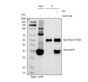 Annexin A1 Antibody Human A431 Cell Immunoprecipitation. Immunoprecipitation of Annexin A1/ANXA1 was performed from human A431 whole cell lysate using Annexin A1 Antibody. Lane 1: 30 ug of A431 input lysate; Lane 2: material immunoprecipitated with rabbit control IgG; Lane 3: material immunoprecipitated with 2 ug of Annexin A1 Antibody from 500 ug of A431 lysate. Western blot detection was performed with Annexin A1 Antibody at 0.5 ug/ml followed by HRP-conjugated secondary antibody and ECL detection. Annexin A1 is detected at approximately 35 kDa, near the expected molecular weight of approximately 39 kDa, demonstrating successful immunoprecipitation of endogenous ANXA1 from human A431 cells.