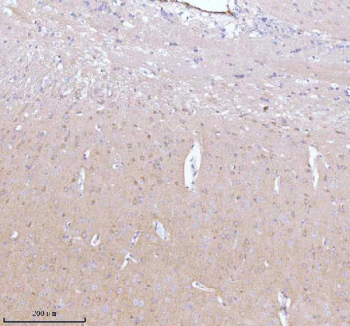 Immunohistochemical staining of GNAI2 using anti-GNAI2 antibody. GNAI2 was detected in a paraffin-embedded section of mouse brain tissue. Heat mediated antigen retrieval was performed in EDTA buffer (pH 8.0, epitope retrieval solution). The tissue section was blocked with 10% goat serum. The tissue section was then incubated with 2 ug/ml rabbit anti-GNAI2 antibody overnight at 4oC. Peroxidase Conjugated Goat Anti-rabbit IgG was used as secondary antibody and incubated for 30 minutes at 37oC. The tissue section was developed using an HRP secondary and DAB substrate.