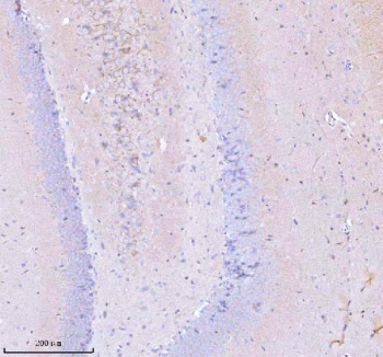 Immunohistochemical staining of GNAI2 using anti-GNAI2 antibody. GNAI2 was detected in a paraffin-embedded section of rat brain tissue. Heat mediated antigen retrieval was performed in EDTA buffer (pH 8.0, epitope retrieval solution). The tissue section was blocked with 10% goat serum. The tissue section was then incubated with 2 ug/ml rabbit anti-GNAI2 antibody overnight at 4oC. Peroxidase Conjugated Goat Anti-rabbit IgG was used as secondary antibody and incubated for 30 minutes at 37oC. The tissue section was developed using an HRP secondary and DAB substrate.