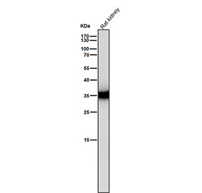 Rat kidney tissue lysate tested with the CASP6 antibody at 1:1000 dilution for 1 hour at room temperature. Expected molecular weight: 34-36 kDa.