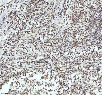 Immunohistochemical staining of IRF2BP1 using anti-IRF2BP1 antibody. IRF2BP1 was detected in a paraffin-embedded section of human tonsil tissue. Heat mediated antigen retrieval was performed in EDTA buffer (pH 8.0, epitope retrieval solution). The tissue section was blocked with 10% goat serum. The tissue section was then incubated with 2 ug/ml rabbit anti-IRF2BP1 antibody overnight at 4oC. Peroxidase Conjugated Goat Anti-rabbit IgG was used as secondary antibody and incubated for 30 minutes at 37oC. The tissue section was developed using an HRP secondary and DAB substrate.