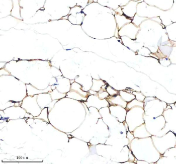 Immunohistochemical staining of SERPINA12 using anti-SERPINA12 antibody. SERPINA12 was detected in a paraffin-embedded section of adipose of rat ovary tissue. Heat mediated antigen retrieval was performed in EDTA buffer (pH 8.0, epitope retrieval solution). The tissue section was blocked with 10% goat serum. The tissue section was then incubated with 2 ug/ml rabbit anti-SERPINA12 antibody overnight at 4oC. Peroxidase Conjugated Goat Anti-rabbit IgG was used as secondary antibody and incubated for 30 minutes at 37oC. The tissue section was developed using an HRP secondary and DAB substrate.