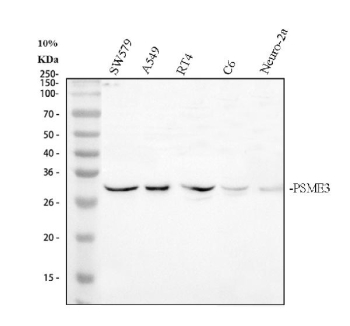 Western blot analysis of PSME3 using anti-PSME3 antibody. Electrophoresis was performed on a 10% SDS-PAGE gel at 80V (Stacking gel) / 120V (Resolving gel) for 2 hours. Lane 1: human SW579 whole cell lysates, Lane 2: human whole cell lysates, Lane 3: human RT4 whole cell lysates, Lane 4: rat C6 whole cell lysates, Lane 5: mouse Neuro-2a whole cell lysates. After electrophoresis, proteins were transferred to a nitrocellulose membrane at 150 mA for 50-90 minutes. Blocked the membrane with 5% non-fat milk/TBS for 1.5 hour at RT. The membrane was incubated with rabbit anti-PSME3 antibody at 0.5 ug/ml overnight at 4oC, then washed with TBS-0.1%Tween 3 times with 5 minutes each and probed with a goat anti-rabbit IgG-HRP secondary antibody at a dilution of 1:5000 for 1.5 hour at RT. The signal is developed using an ECL Plus Western Blotting Substratewith Tanon 5200 system. A specific band was detected for PSME3 at approximately 30 kDa. The expected molecular weight of PSME3 is ~30 kDa.